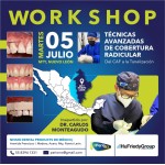 Técnicas Avanzadas de Cobertura Radicular $USD